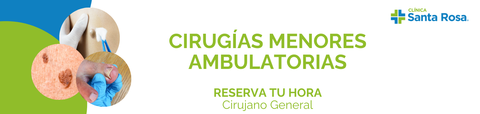 cirugía menor